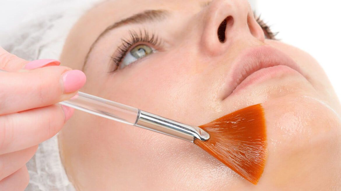 PEELING QUÍMICO